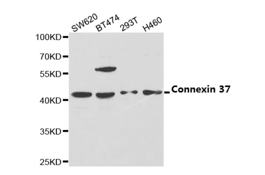 Anti-Connexin 37 Antibody from Bioworld Technology (BS6988) - Antibodies.com