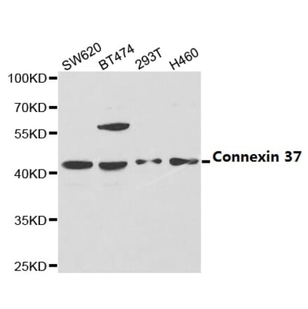 Anti-Connexin 37 Antibody from Bioworld Technology (BS6988) - Antibodies.com