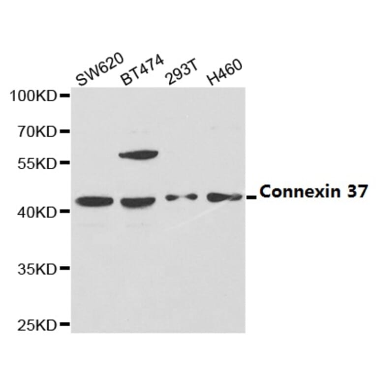Anti-Connexin 37 Antibody from Bioworld Technology (BS6988) - Antibodies.com