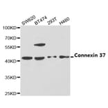 Anti-Connexin 37 Antibody from Bioworld Technology (BS6988) - Antibodies.com