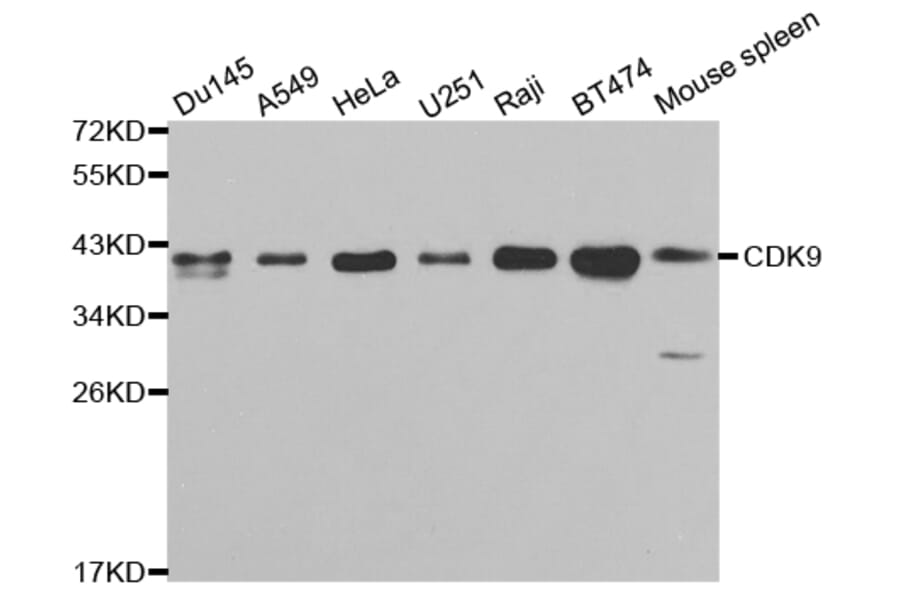 Anti-CDK9 Antibody from Bioworld Technology (BS6990) - Antibodies.com