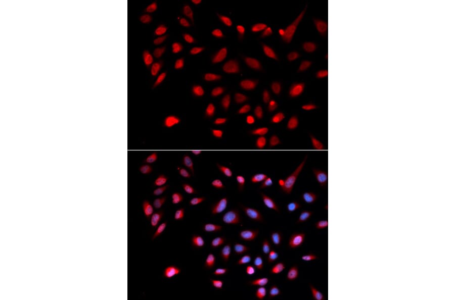 Anti-CDK9 Antibody from Bioworld Technology (BS6990) - Antibodies.com