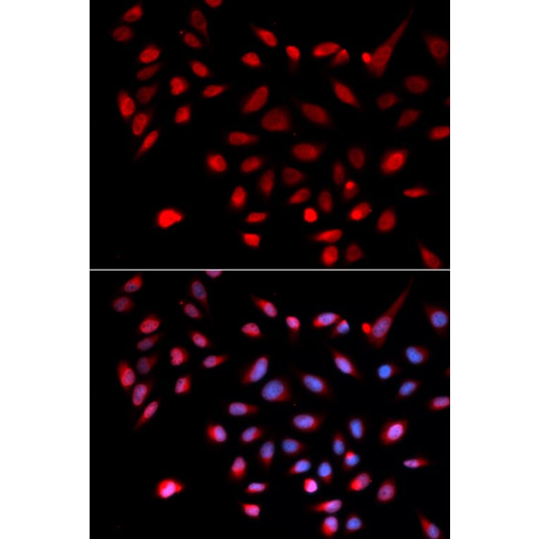 Anti-CDK9 Antibody from Bioworld Technology (BS6990) - Antibodies.com