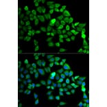 Anti-CUL 2 Antibody from Bioworld Technology (BS6991) - Antibodies.com