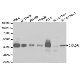 Anti-CXADR Antibody from Bioworld Technology (BS6992) - Antibodies.com