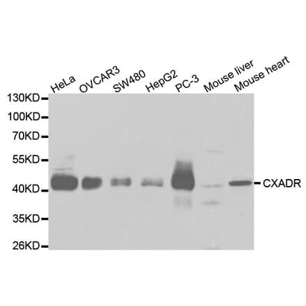 Anti-CXADR Antibody from Bioworld Technology (BS6992) - Antibodies.com