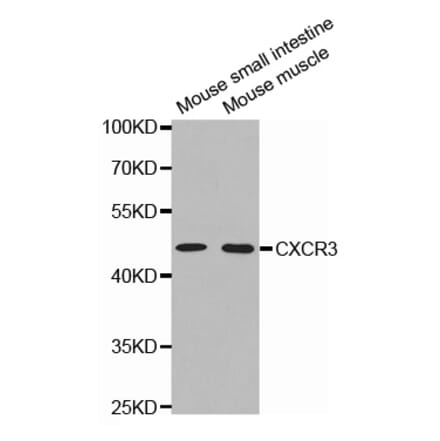Anti-CXCR-3 Antibody from Bioworld Technology (BS6993) - Antibodies.com