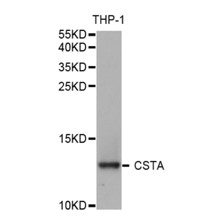 Anti-Cystatin A Antibody from Bioworld Technology (BS6994) - Antibodies.com