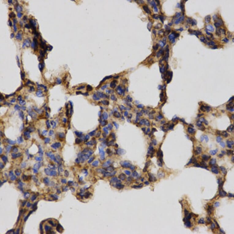 Anti-Cystatin A Antibody from Bioworld Technology (BS6994) - Antibodies.com