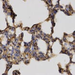 Anti-Cystatin A Antibody from Bioworld Technology (BS6994) - Antibodies.com