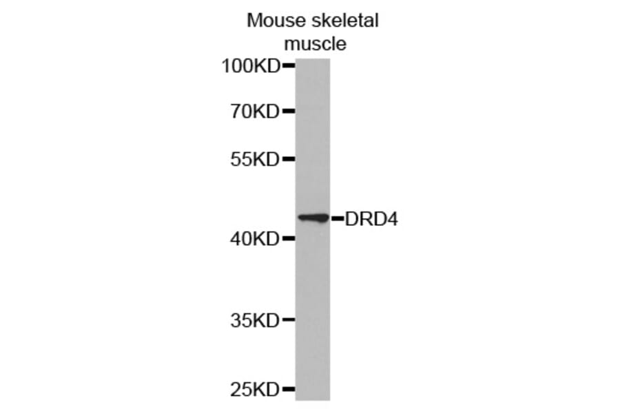 Anti-D4DR Antibody from Bioworld Technology (BS6997) - Antibodies.com