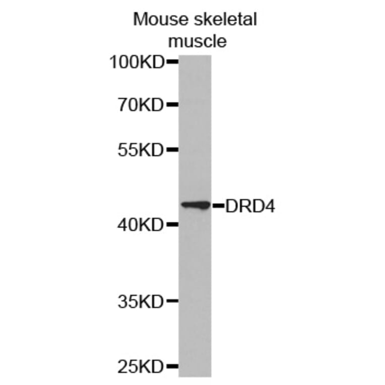 Anti-D4DR Antibody from Bioworld Technology (BS6997) - Antibodies.com