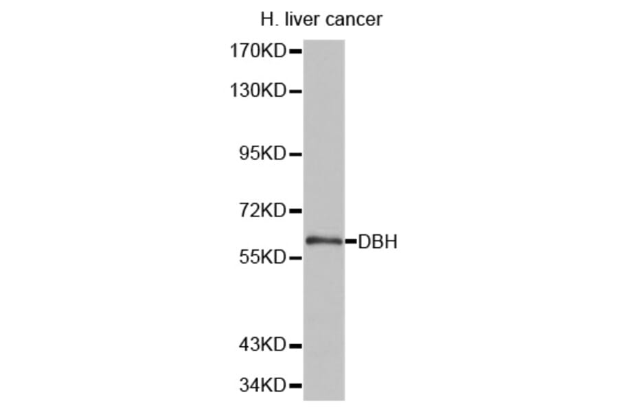 Anti-DBH Antibody from Bioworld Technology (BS6998) - Antibodies.com