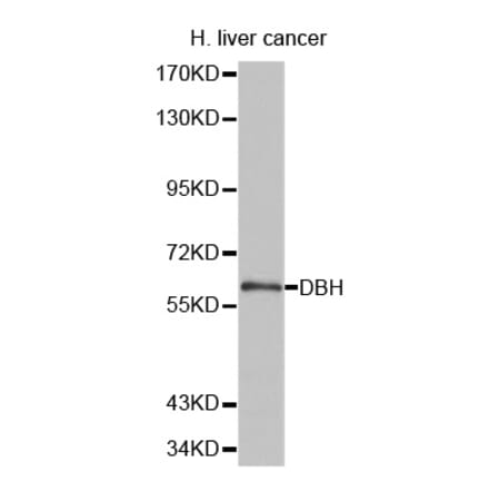 Anti-DBH Antibody from Bioworld Technology (BS6998) - Antibodies.com