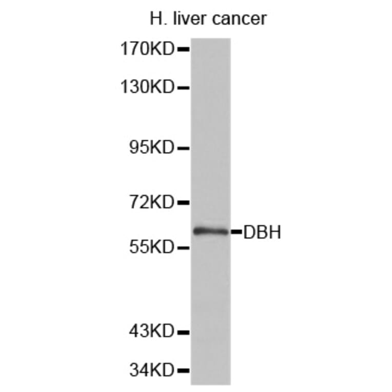 Anti-DBH Antibody from Bioworld Technology (BS6998) - Antibodies.com
