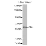 Anti-DBH Antibody from Bioworld Technology (BS6998) - Antibodies.com