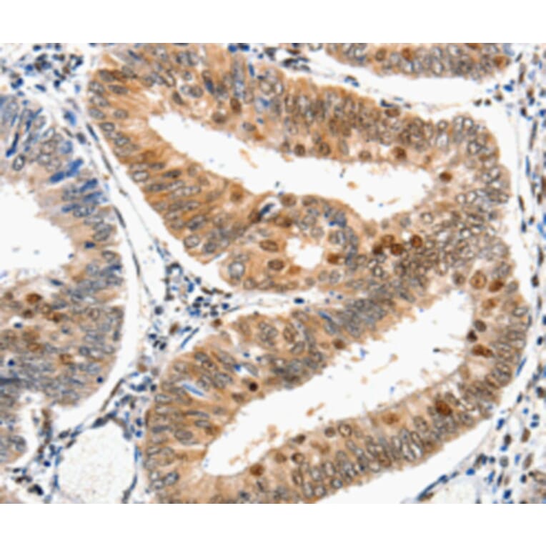 Anti-DDB1 Antibody from Bioworld Technology (BS6999) - Antibodies.com