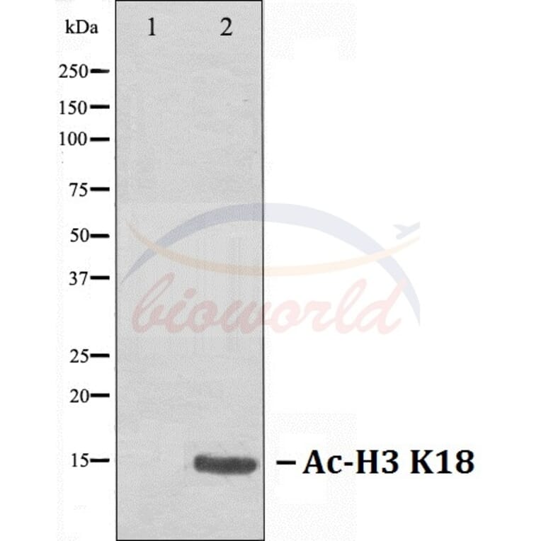 Anti-Histone H3 (Acetyl-K18) Antibody from Bioworld Technology (BS70006) - Antibodies.com