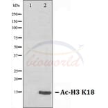 Anti-Histone H3 (Acetyl-K18) Antibody from Bioworld Technology (BS70006) - Antibodies.com