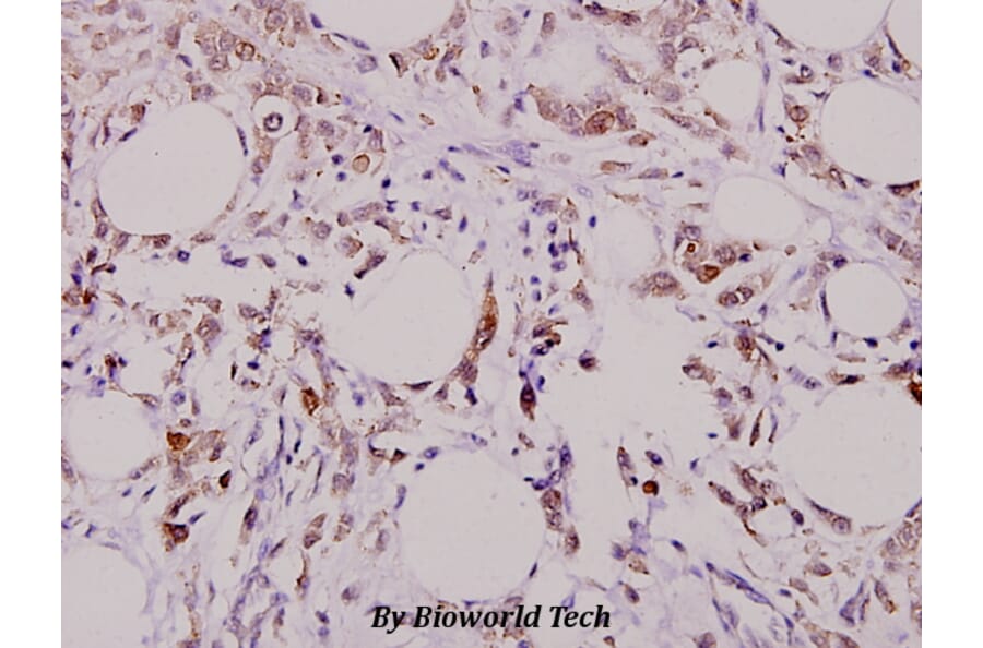 Anti-Actived-Caspase-3 p17 Antibody from Bioworld Technology (BS7004) - Antibodies.com