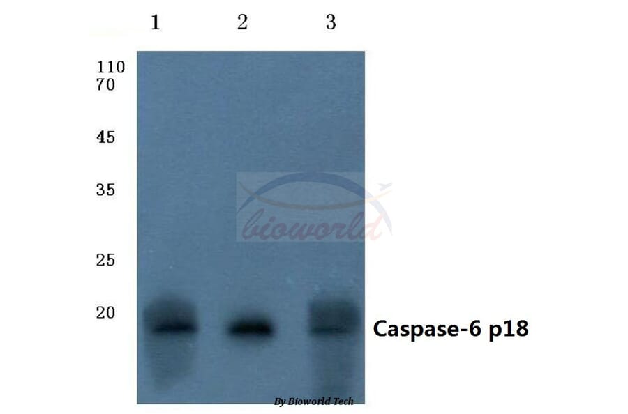 Anti-Caspase-6 p18 (D179) Antibody from Bioworld Technology (BS7005) - Antibodies.com