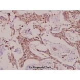 Anti-Caspase-6 p18 (D179) Antibody from Bioworld Technology (BS7005) - Antibodies.com