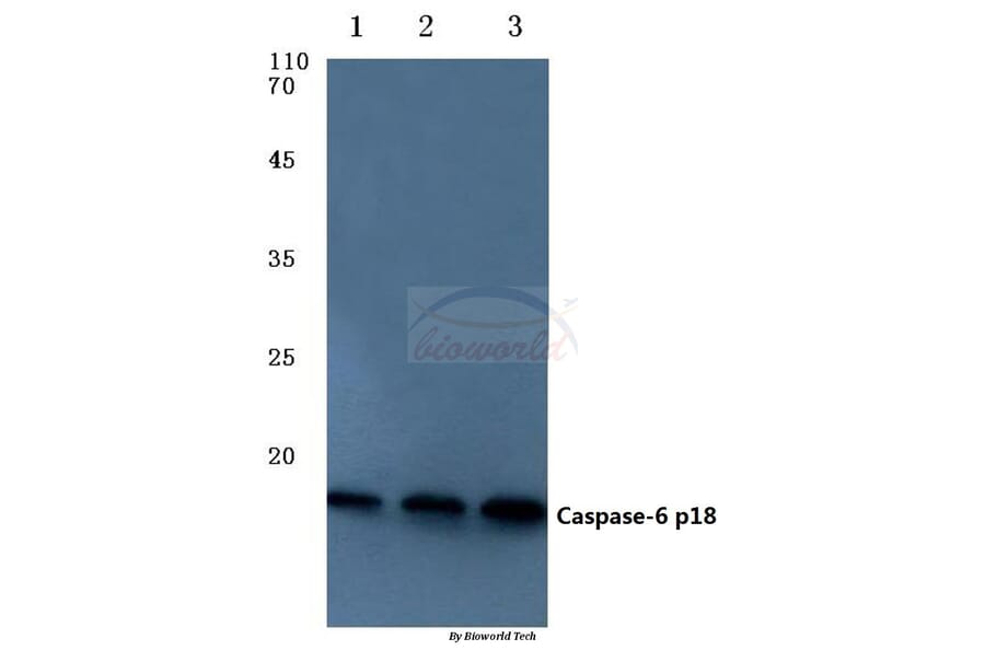 Anti-Caspase-6 p18 (D162) Antibody from Bioworld Technology (BS7006) - Antibodies.com