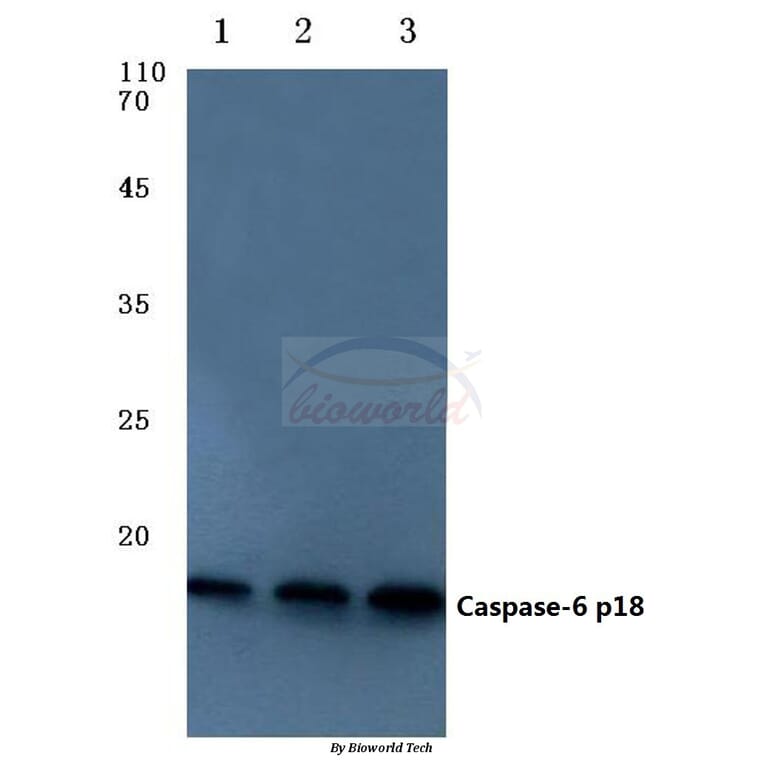 Anti-Caspase-6 p18 (D162) Antibody from Bioworld Technology (BS7006) - Antibodies.com