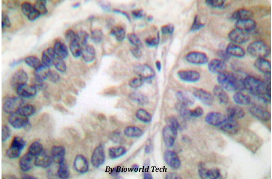 Anti-Caspase-6 p18 (D162) Antibody from Bioworld Technology (BS7006) - Antibodies.com