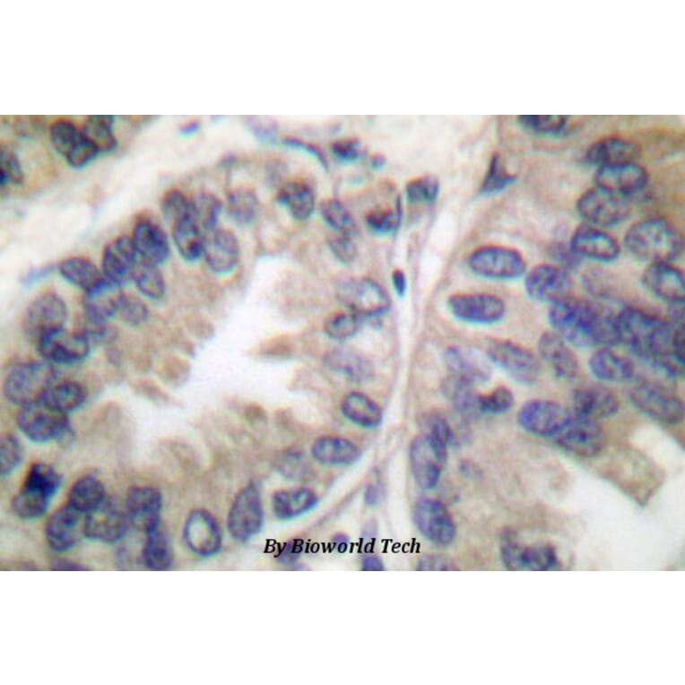 Anti-Caspase-6 p18 (D162) Antibody from Bioworld Technology (BS7006) - Antibodies.com