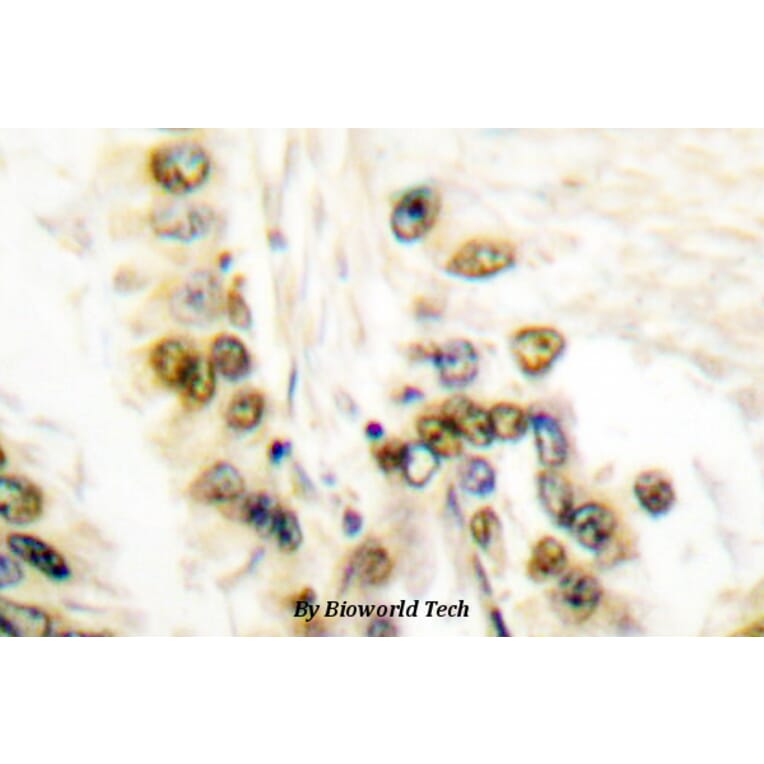 Anti-Cleaved-Lamin A (D230-) Antibody from Bioworld Technology (BS7013) - Antibodies.com