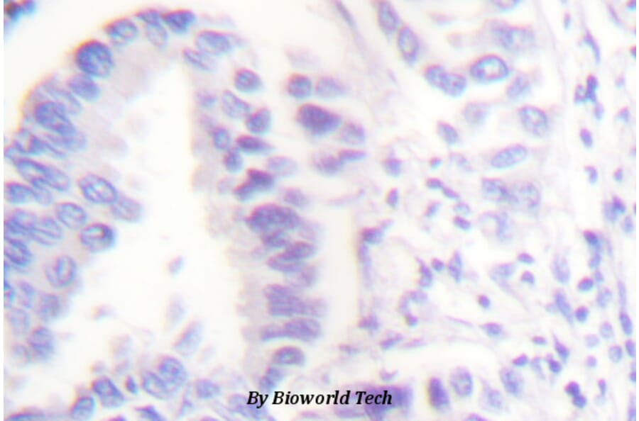 Anti-Cleaved-Lamin A (D230+) Antibody from Bioworld Technology (BS7014) - Antibodies.com