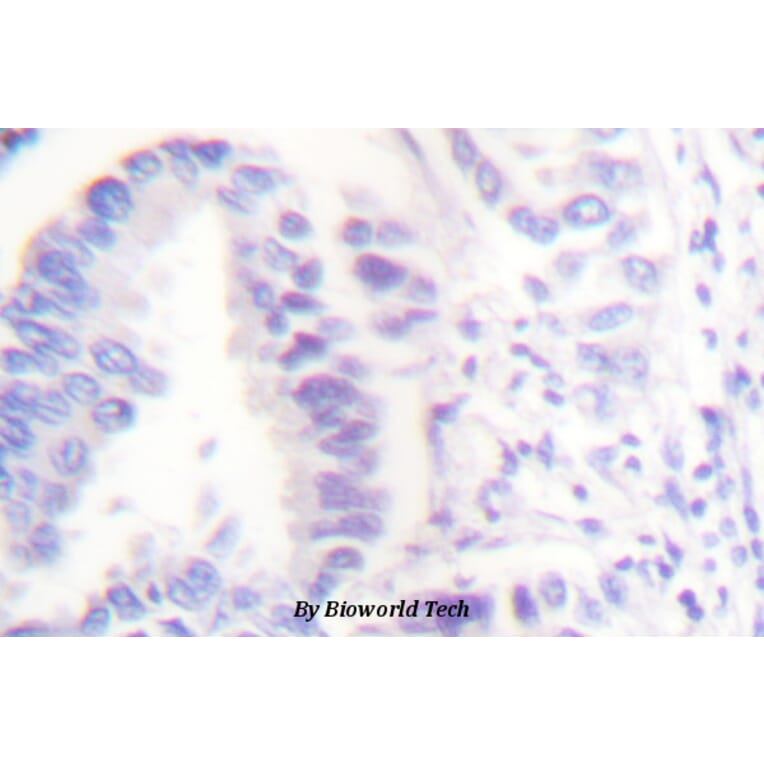 Anti-Cleaved-Lamin A (D230+) Antibody from Bioworld Technology (BS7014) - Antibodies.com