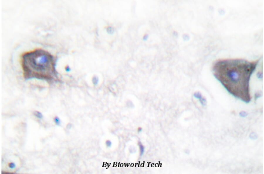 Anti-Cleaved-Notch 1 (V1754) Antibody from Bioworld Technology (BS7018) - Antibodies.com
