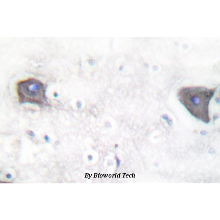 Anti-Cleaved-Notch 1 (V1754) Antibody from Bioworld Technology (BS7018) - Antibodies.com
