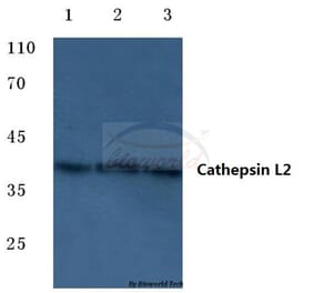 Anti-Cathepsin L2 (L114) Antibody from Bioworld Technology (BS7023) - Antibodies.com