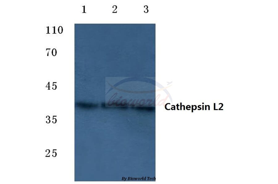 Anti-Cathepsin L2 (L114) Antibody from Bioworld Technology (BS7023) - Antibodies.com
