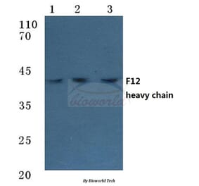Anti-F12 (HC) Antibody from Bioworld Technology (BS7026) - Antibodies.com