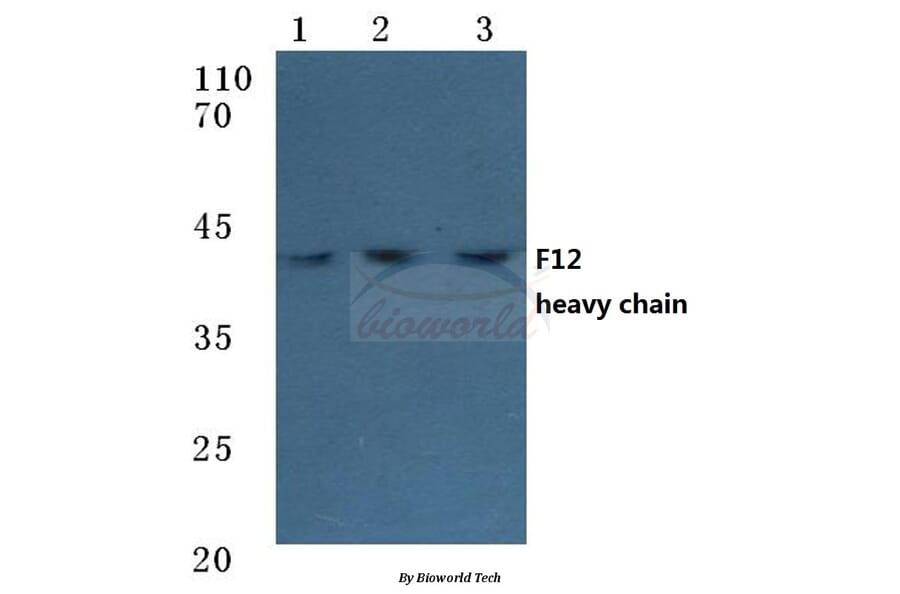 Anti-F12 (HC) Antibody from Bioworld Technology (BS7026) - Antibodies.com