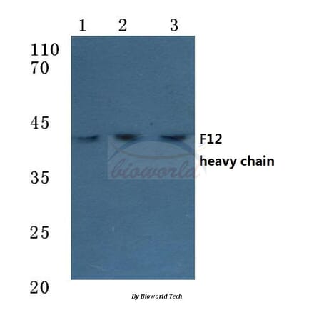 Anti-F12 (HC) Antibody from Bioworld Technology (BS7026) - Antibodies.com
