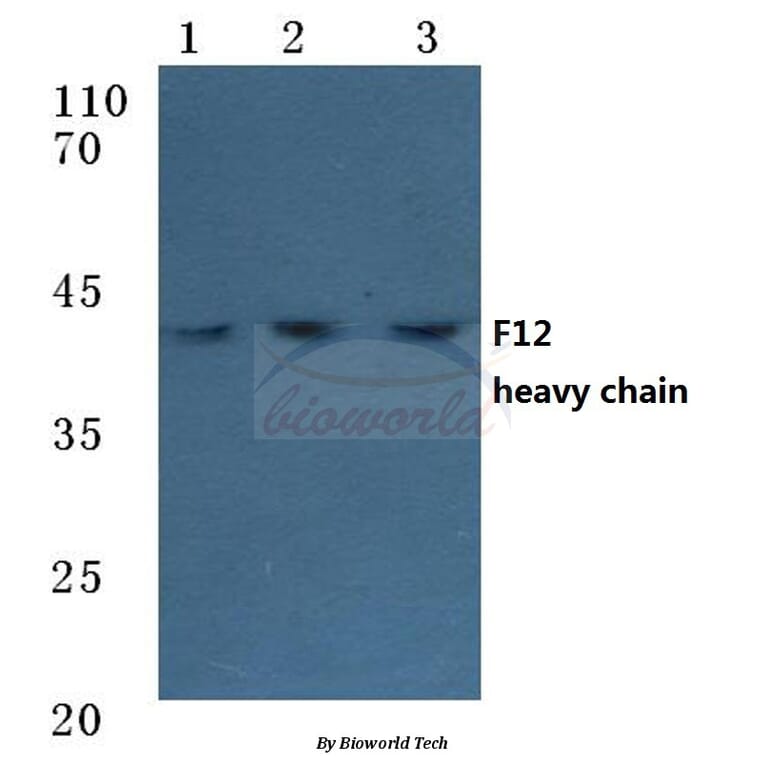 Anti-F12 (HC) Antibody from Bioworld Technology (BS7026) - Antibodies.com