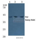Anti-F12 (HC) Antibody from Bioworld Technology (BS7026) - Antibodies.com