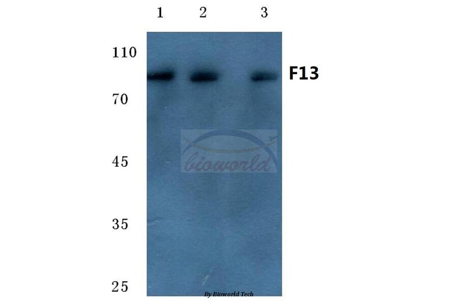 Anti-Factor 13 A (G39) Antibody from Bioworld Technology (BS7027) - Antibodies.com