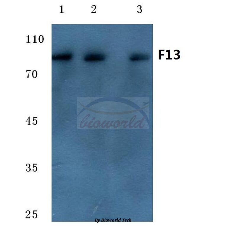 Anti-Factor 13 A (G39) Antibody from Bioworld Technology (BS7027) - Antibodies.com