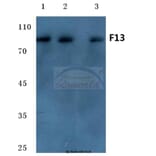 Anti-Factor 13 A (G39) Antibody from Bioworld Technology (BS7027) - Antibodies.com