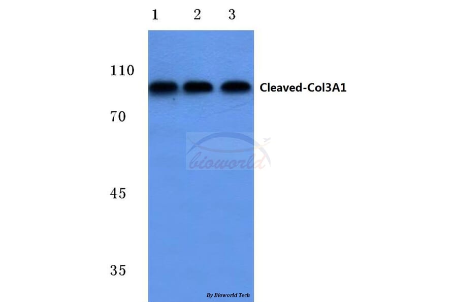 Anti-Cleaved-Collagen 3A1 (G1221) Antibody from Bioworld Technology (BS7028) - Antibodies.com