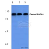 Anti-Cleaved-Collagen 3A1 (G1221) Antibody from Bioworld Technology (BS7028) - Antibodies.com