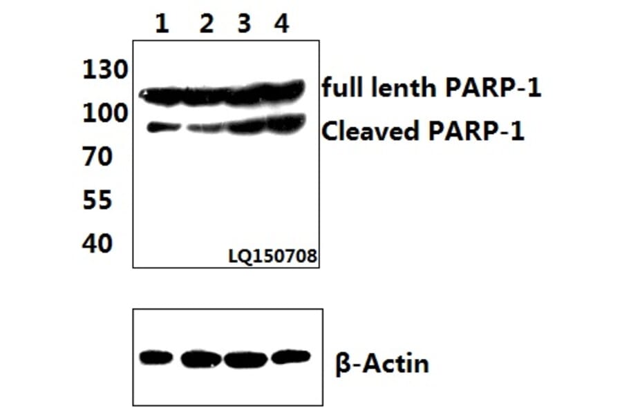 Anti-PARP-1 (D214) Antibody from Bioworld Technology (BS7047) - Antibodies.com