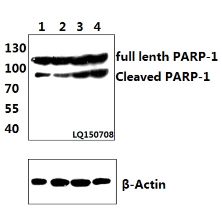 Anti-PARP-1 (D214) Antibody from Bioworld Technology (BS7047) - Antibodies.com