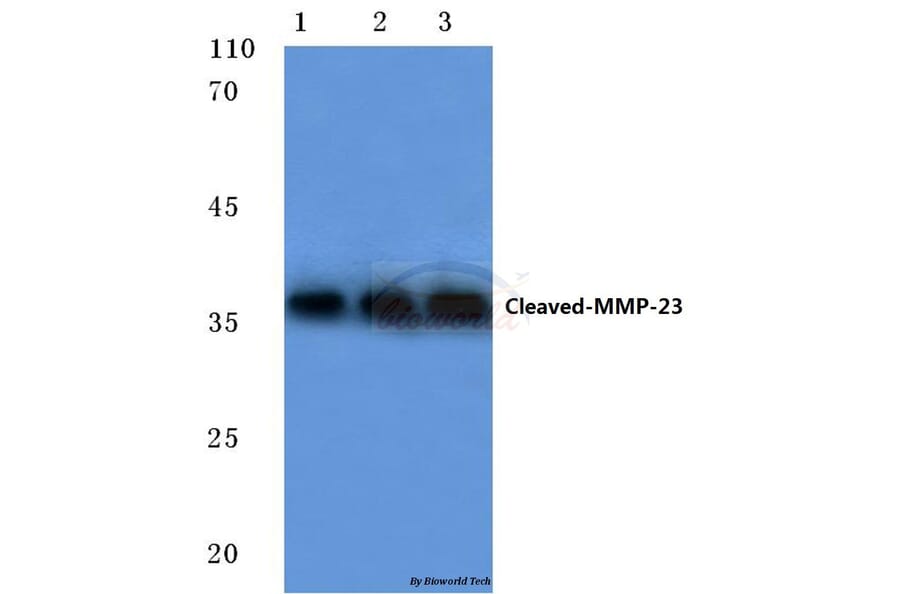 Anti-Cleaved-MMP-23 (Y79) Antibody from Bioworld Technology (BS7054) - Antibodies.com